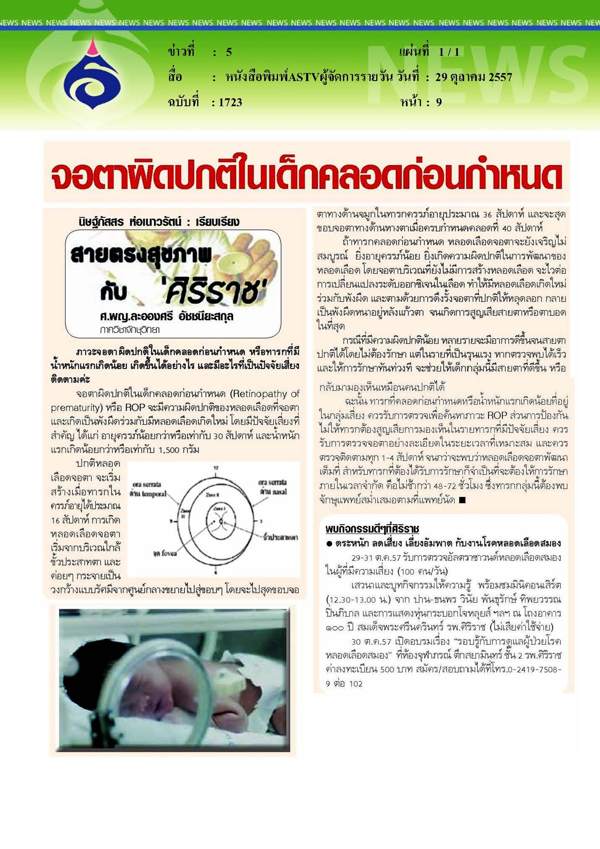 ASTV ผู้จัดการรายวัน : จอตาผิดปกติในเด็กคลอดก่อนกำหนด