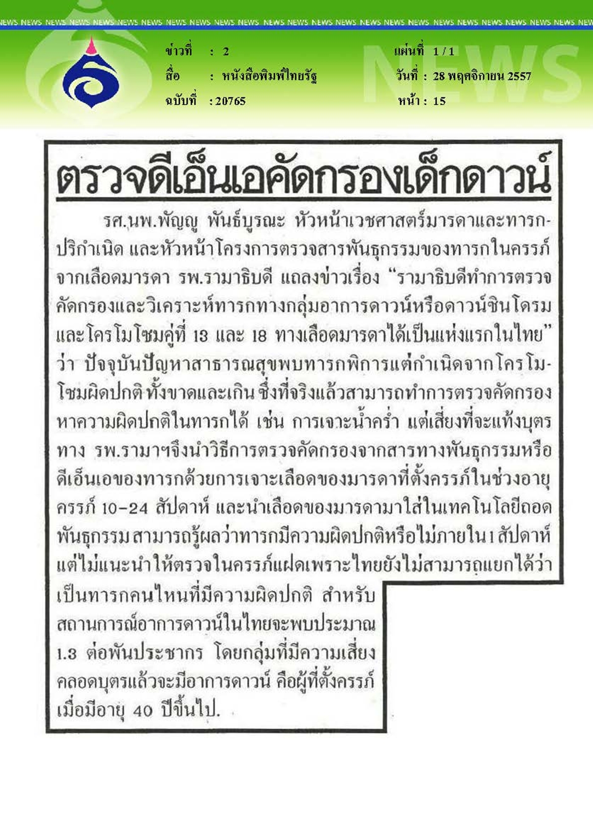 ไทยรัฐ : ตรวจดีเอ็นเอคัดกรองเด็กดาวน์