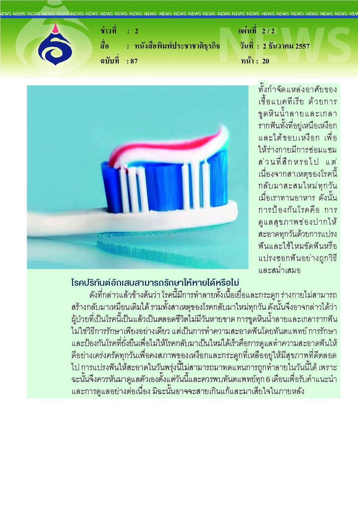 ประชาชาติธุรกิจ : โรคปริทันต์อักเสบ