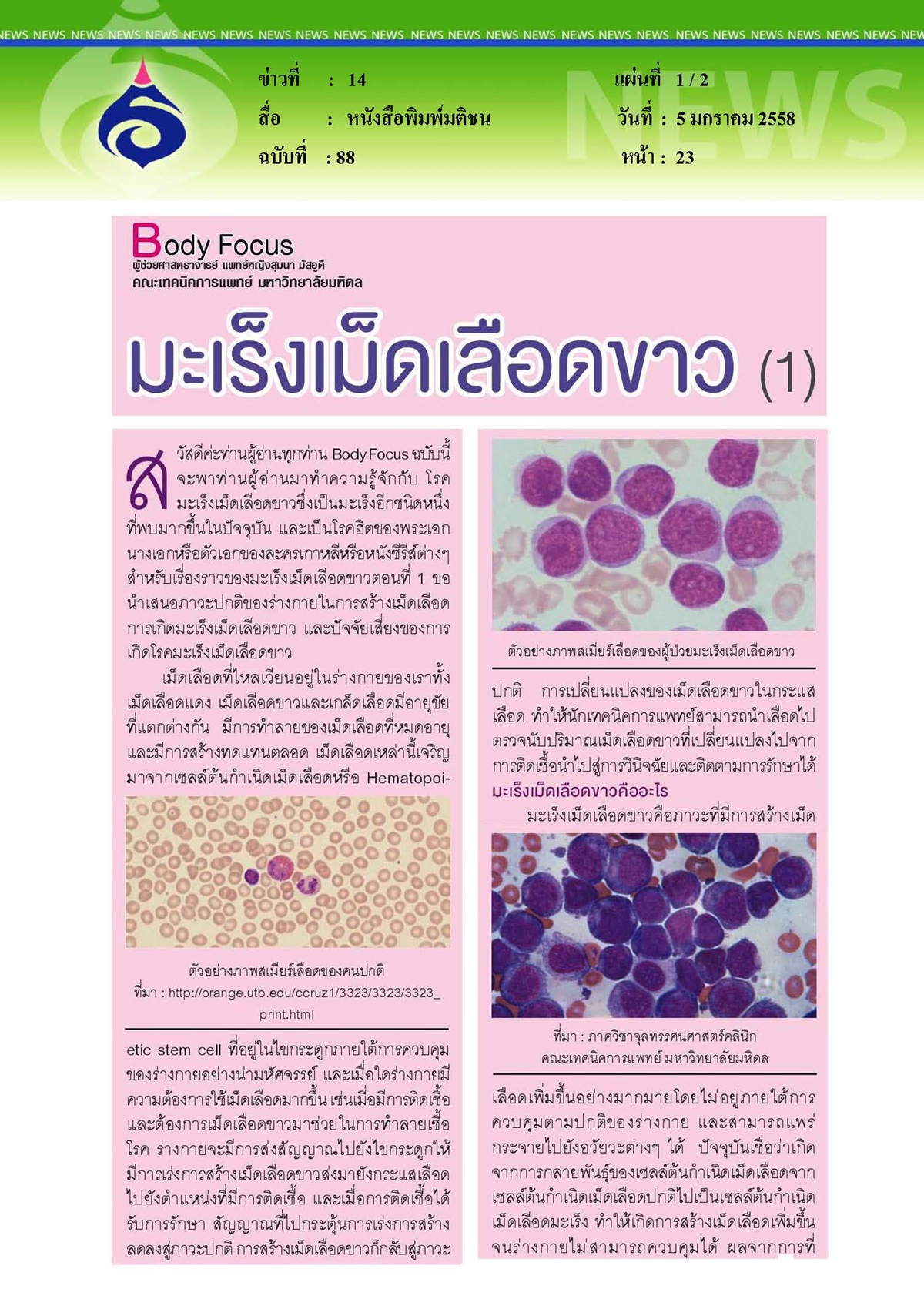 มติชน : มะเร็งเม็ดเลือดขาว ตอนที่ 1