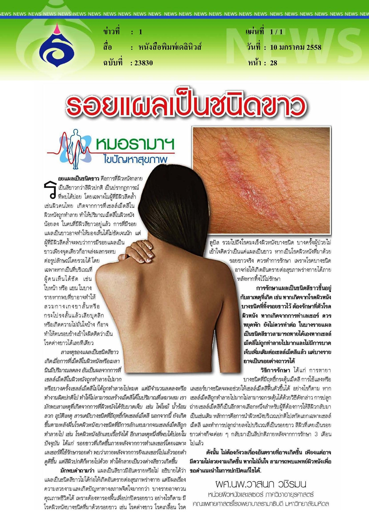 เดลินิวส์ : รอยแผลเป็นชนิดขาว