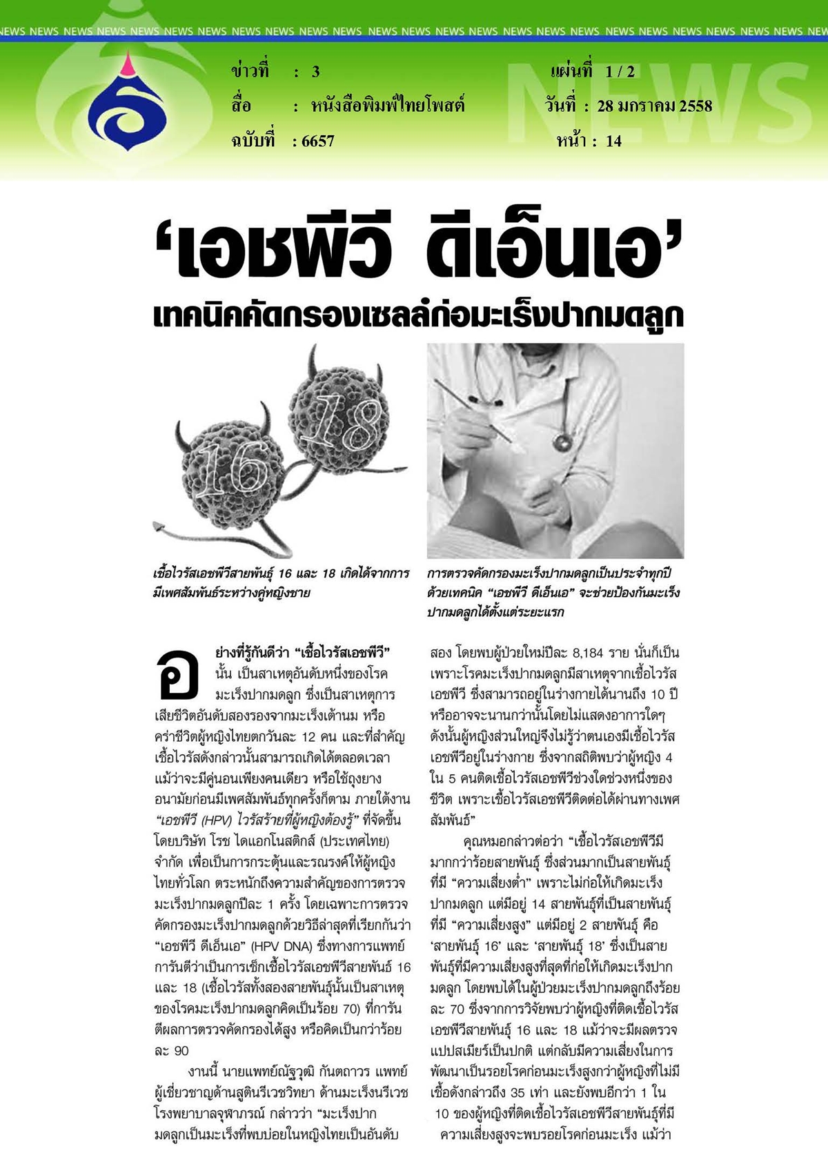ไทยโพสต์ : เอชพีวี ดีเอ็นเอ...เทคนิคคัดกรองเซลล์ก่อมะเร็งปากมดลูก