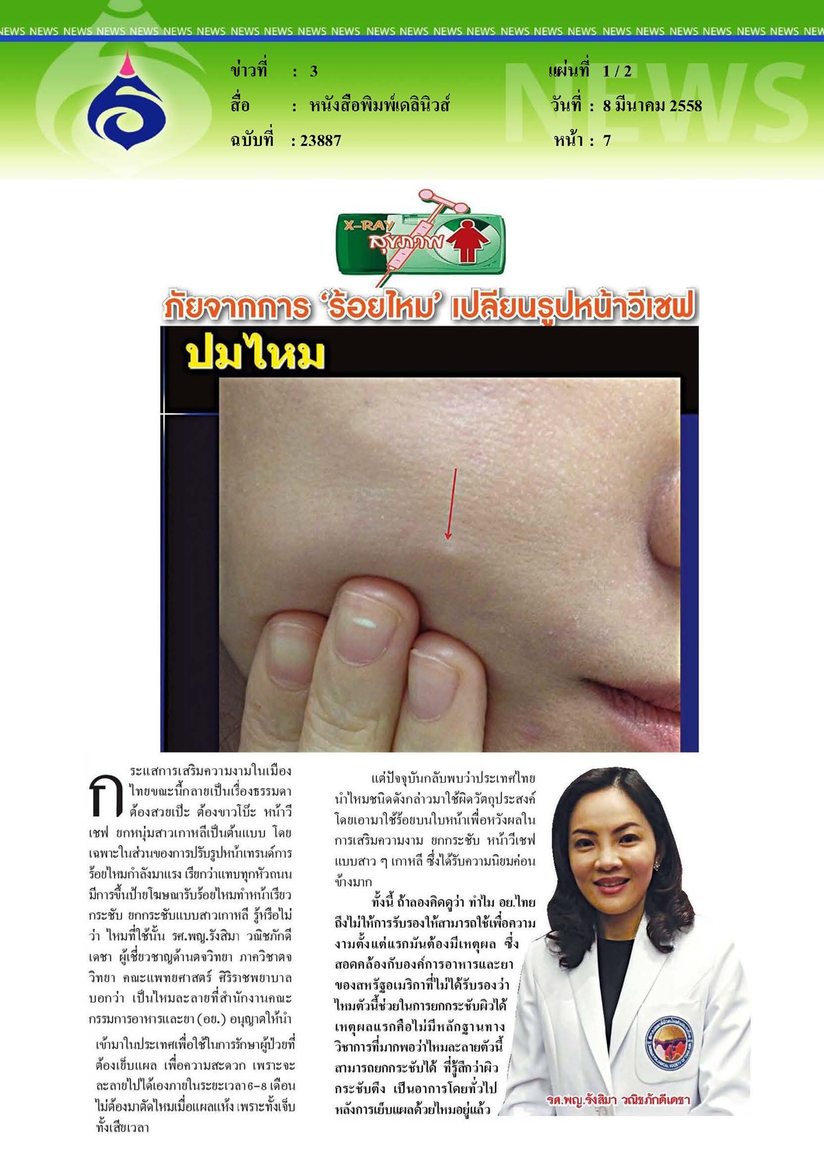 เดลินิวส์ : ภัยจากการร้อยไหม