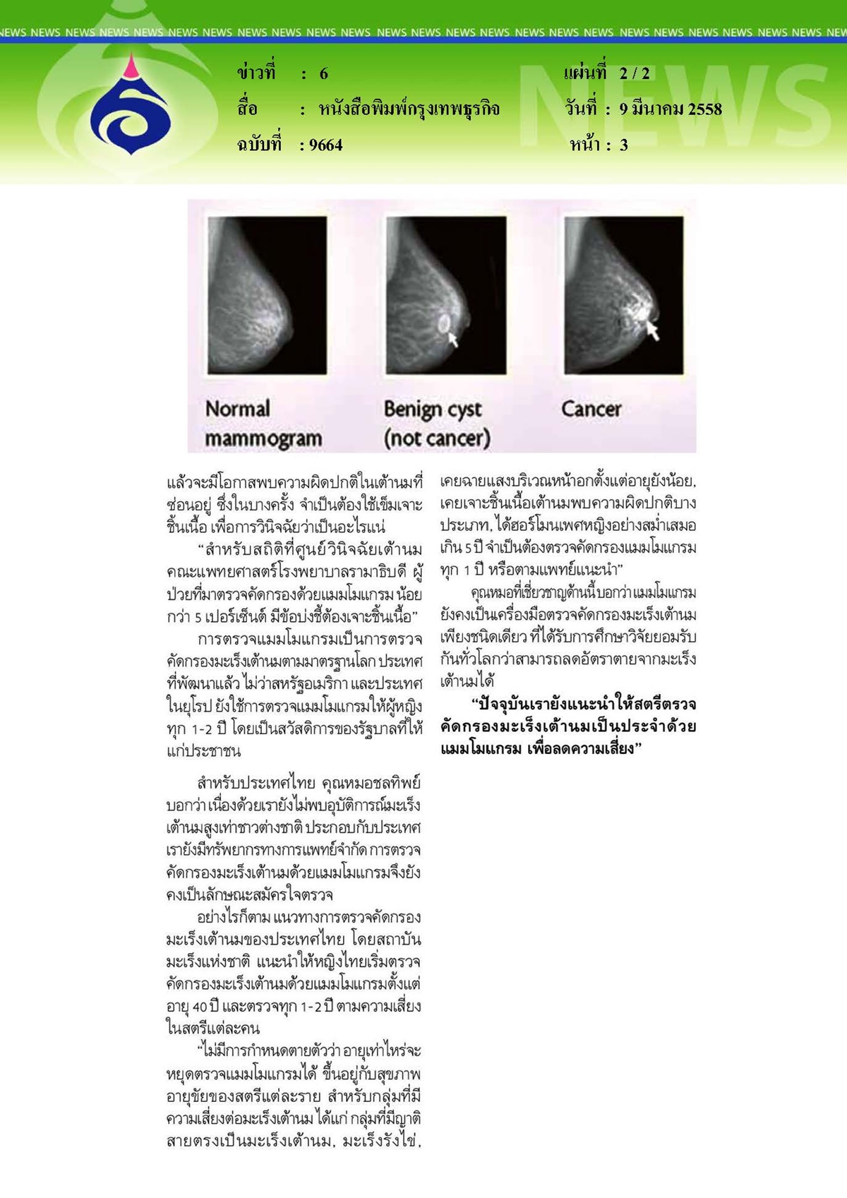 กรุงเทพธุรกิจ : คัดกรองมะเร็งด้วยแมมโมแกรม
