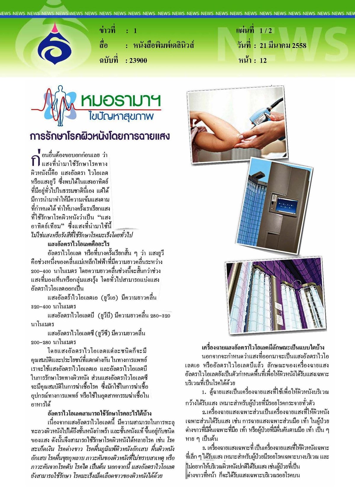 เดลินิวส์ : การรักษาโรคผิวหนังโดยการฉายแสง