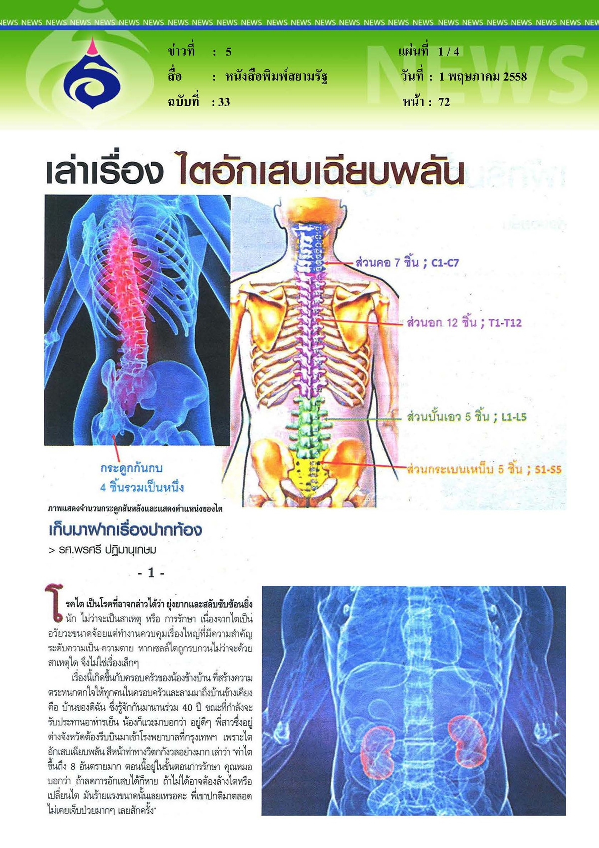 สยามรัฐ : ไตอักเสบเฉียบพลัน