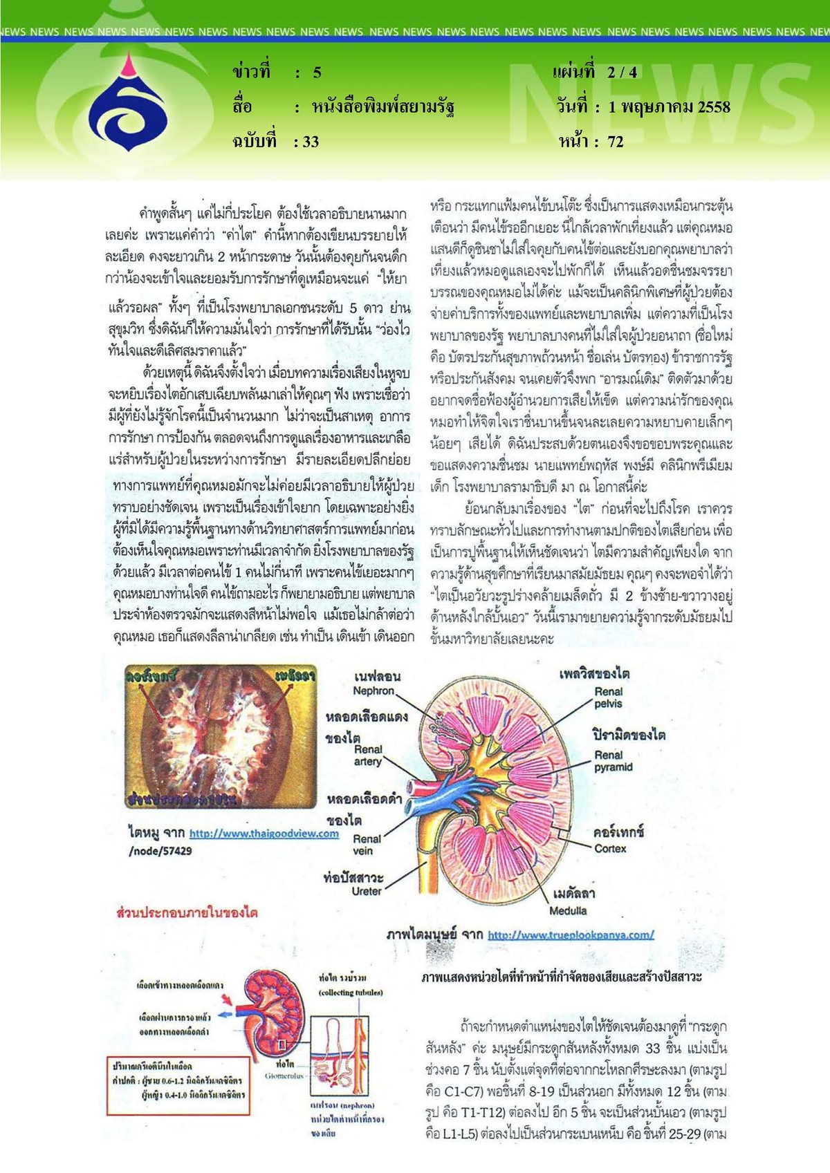สยามรัฐ : ไตอักเสบเฉียบพลัน