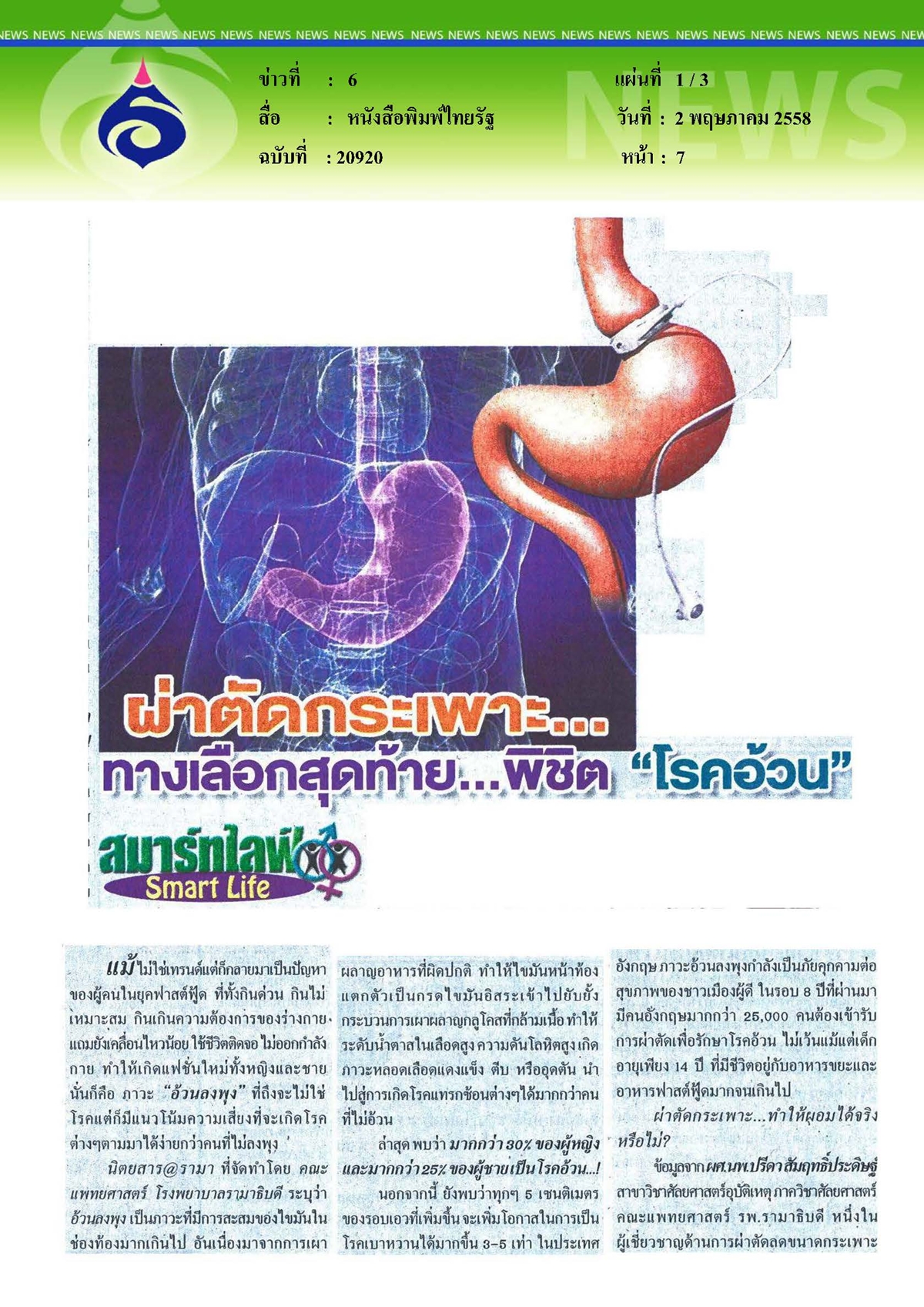 ไทยรัฐ : ผ่าตัดกระเพาะ...ทางเลือกสุดท้ายพิชิตโรคอ้วน