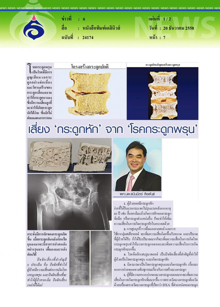 หนังสือพิมพ์เดลินิวส์ เสี่ยง 'กระดูกหัก' จาก 'โรคกระดูกพรุน