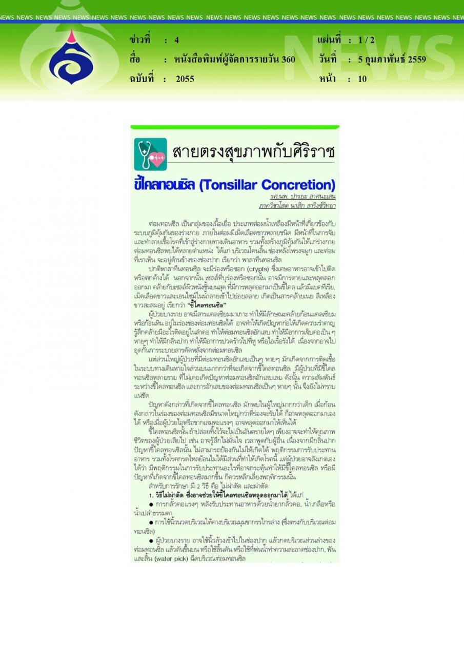หนังสือพิมพ์ผู้จัดการรายวัน 360 สายตรงสุขภาพกับศิริราช ขี้ไคลทอนซิล (Tonsillar Concretion)
