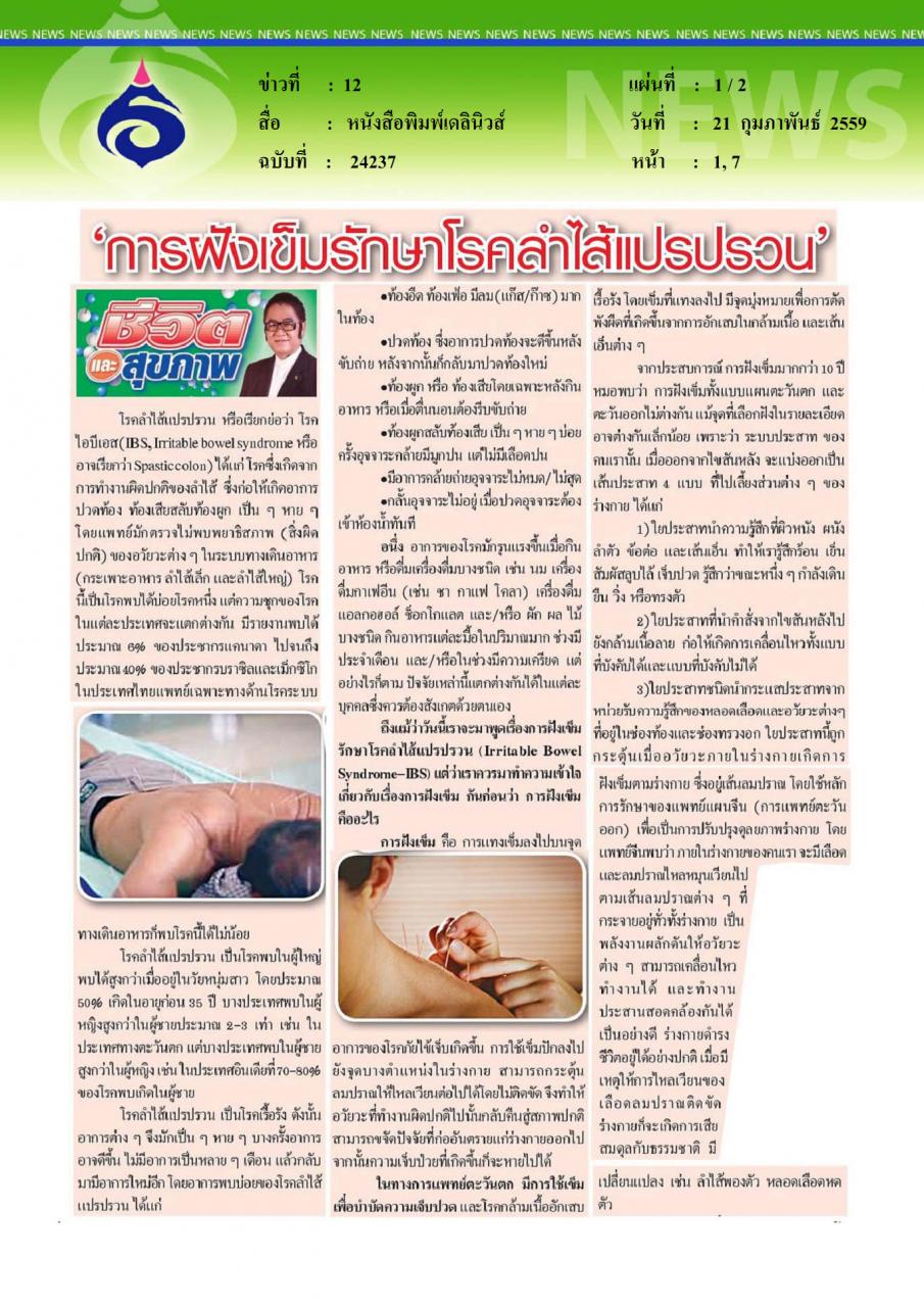 หนังสือพิมพ์เดลินิวส์ การฝังเข็มรักษาโรคลำไส้แปรปรวน