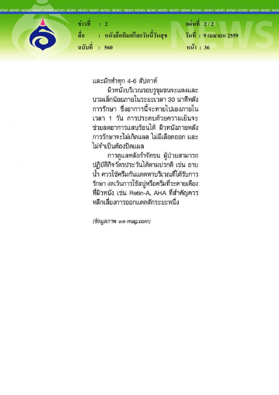 หนังสือพิมพ์โลกวันนี้วันสุข พบหมอศิริราช ตอน กำจัดขนด้วยเลเซอร์