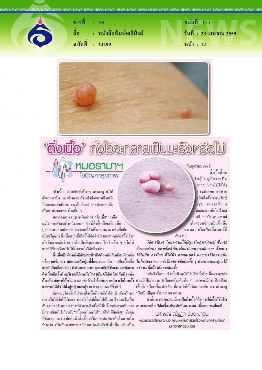 หนังสือพิมพ์เดลินิวส์  ตื่งเนื้อ ทิ้งไว้จะกลายเป็นมะเร็งหรือไม่