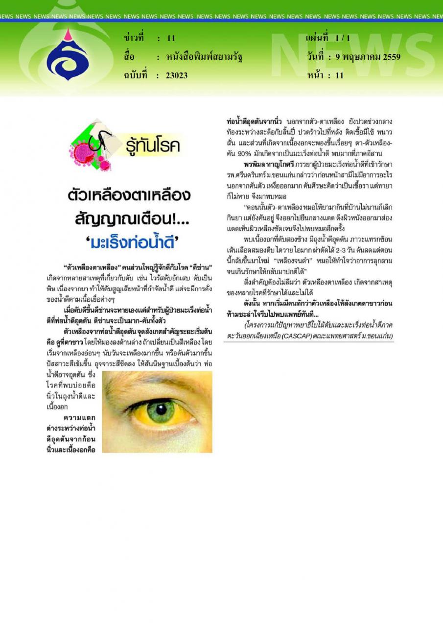หนังสือพิมพ์สยามรัฐ ตัวเหลืองตาเหลือง สัญาณเตือนมะเร็งท่อน้ำดี