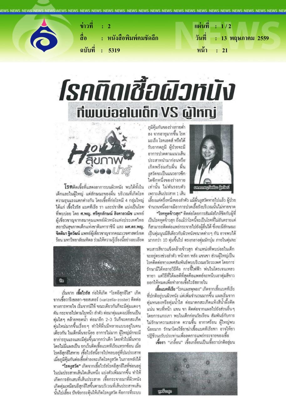 หนังสือพิมพ์คมชัดลึก โรคติดเชื้อผิวหนังที่พบบ่อยในเด็ก VS ผู้ใหญ่