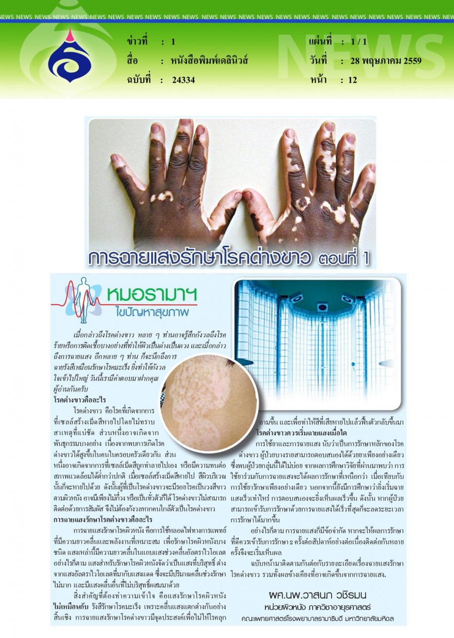 หนังสือพิมพ์เดลินิวส์ หมอรามาฯไขปัญหาสุขภาพ ตอน การฉายแสงรักษาโรคด่างขาว (ตอนที่ 1)