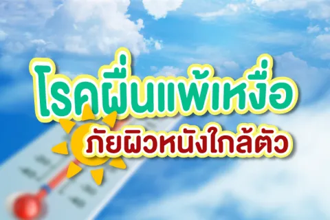 โรคผื่นแพ้เหงื่อ ภัยผิวหนังใกล้ตัว