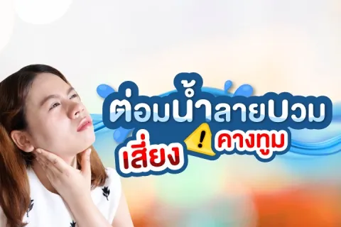 ต่อมน้ำลายบวม เสี่ยง ! คางทูม