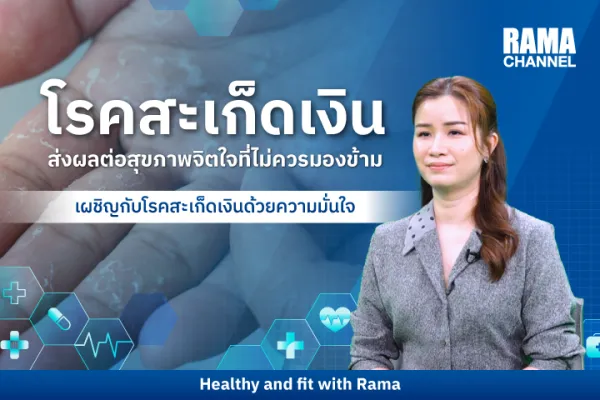 เผชิญกับ โรคสะเก็ดเงิน ด้วยความมั่นใจ