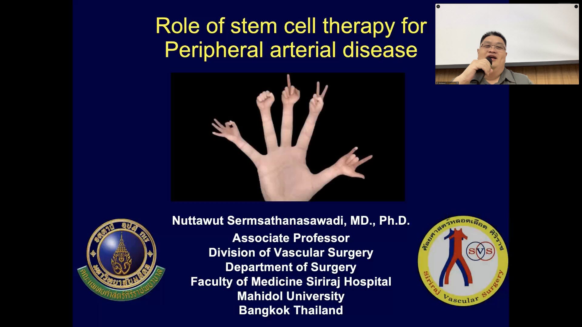 Role of stem Cell Therapy in PAD