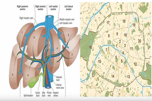 The Brisbane 2000 Terminology of Liver Anatomy and Resections