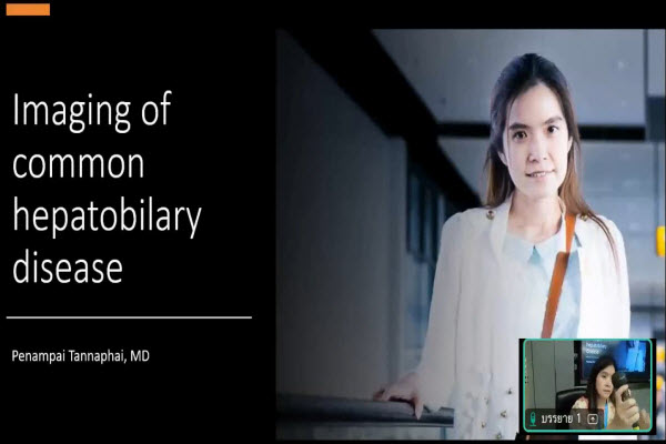 Imaging of hepatobilary