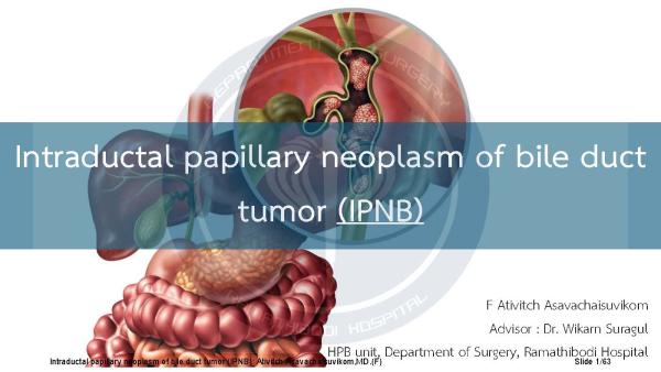 Intraductal papillary neoplasm