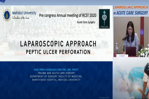 Laparoscopic approach in PU Perforation Indication