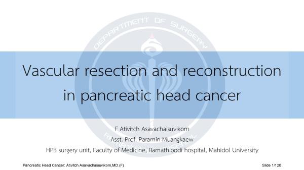 Pancreatic Head Cancer