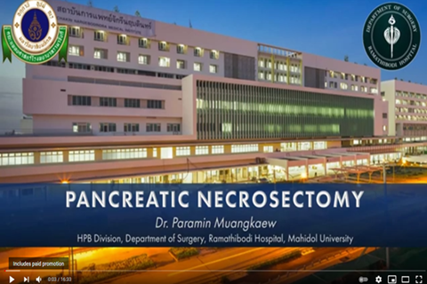 Pancreatic necrosectomy for resident