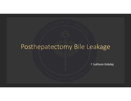 Posthepatectomy Bile Leakage