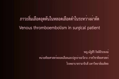 VDO Venous thromboembolism in surgical patient