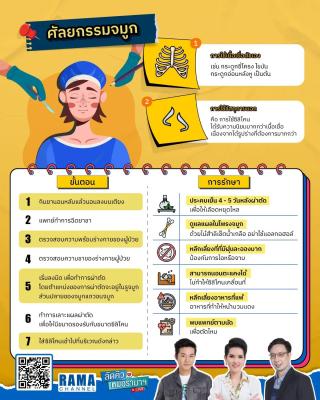 ศัลยกรรมจมูก