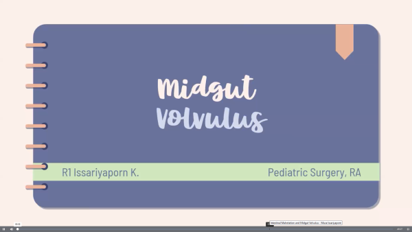 Intestinal Malrotation and Midgut Volvulus