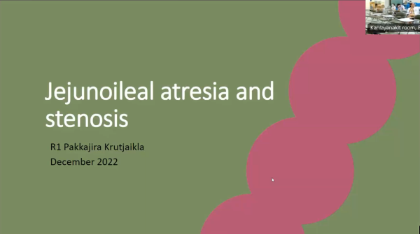 Jejunoileal atresia 