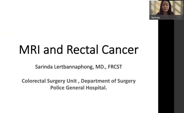 MRI and Cancer