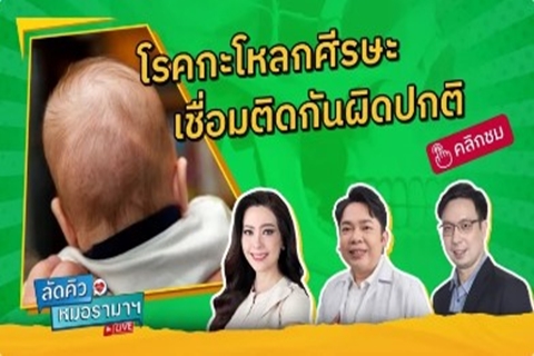 โรคกะโหลกศีรษะ เชื่อมติดกันผิดปกติ