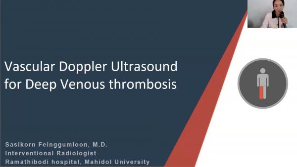Duplex ultrasound for Deep venous thrombosis