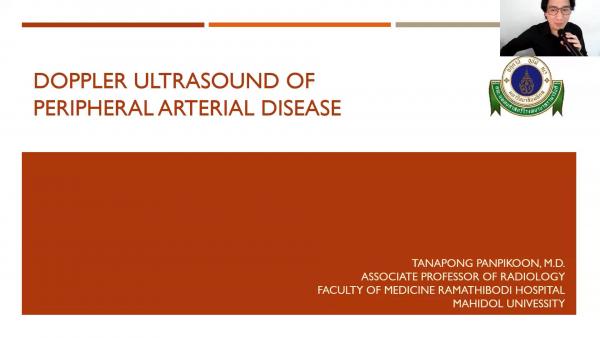 Duplex ultrasound for Peripheral Artery Disease