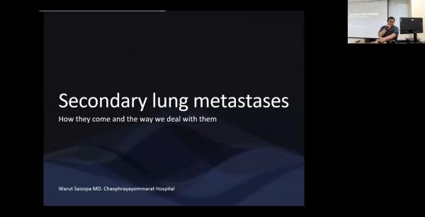 Secondary Lung Tumors