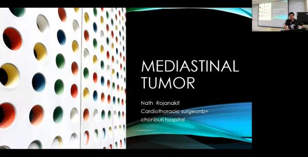 Anterior Mediastinal Tumor