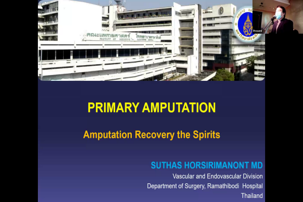 Primary Amputation