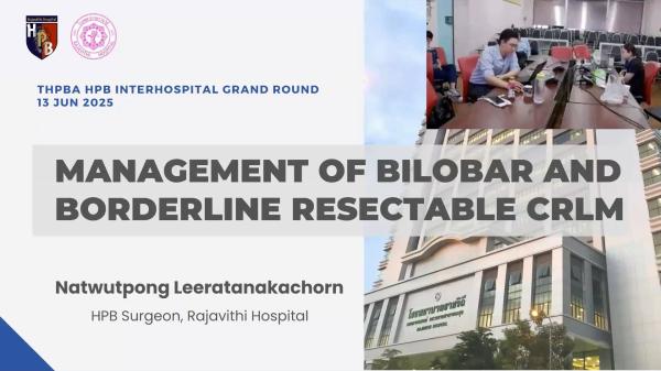 Bilobar-Borderline CRLM