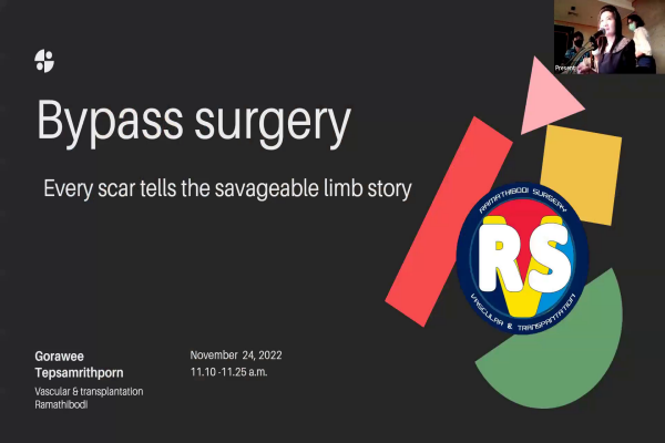 Bypass Surgery