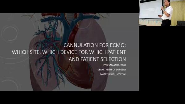Cannulation for ECHO