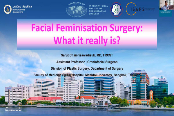 Facial feminization