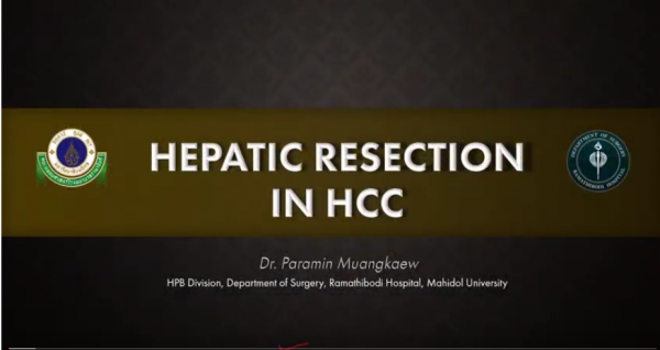 Hepatic resection in HCC for resident (Thai)
