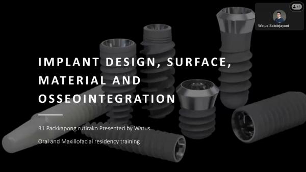 Implant Design, Surface, Material and Osseointegration