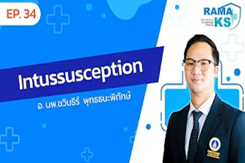 INTUSSUSCEPTION