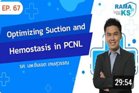 Optimizing Suction and Hemostasis in PCNL